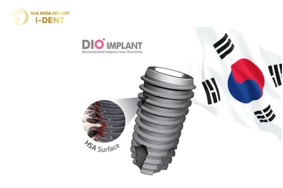Trụ Dio Hàn Quốc Trụ Dio Hàn Quốc