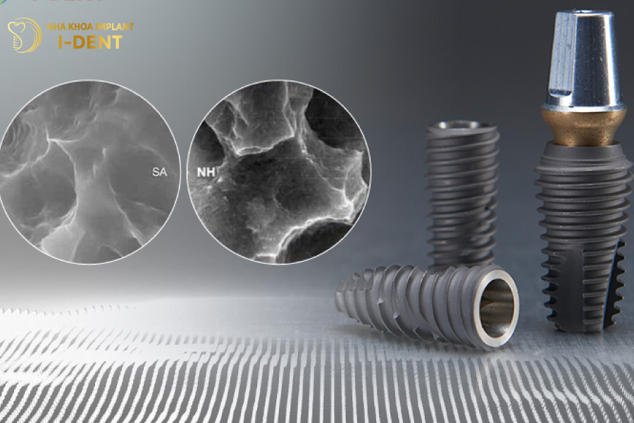 Hiossen Implant có tuổi thọ bền lâu nếu được chăm sóc tốt Hiossen Implant có tuổi thọ bền lâu nếu được chăm sóc tốt