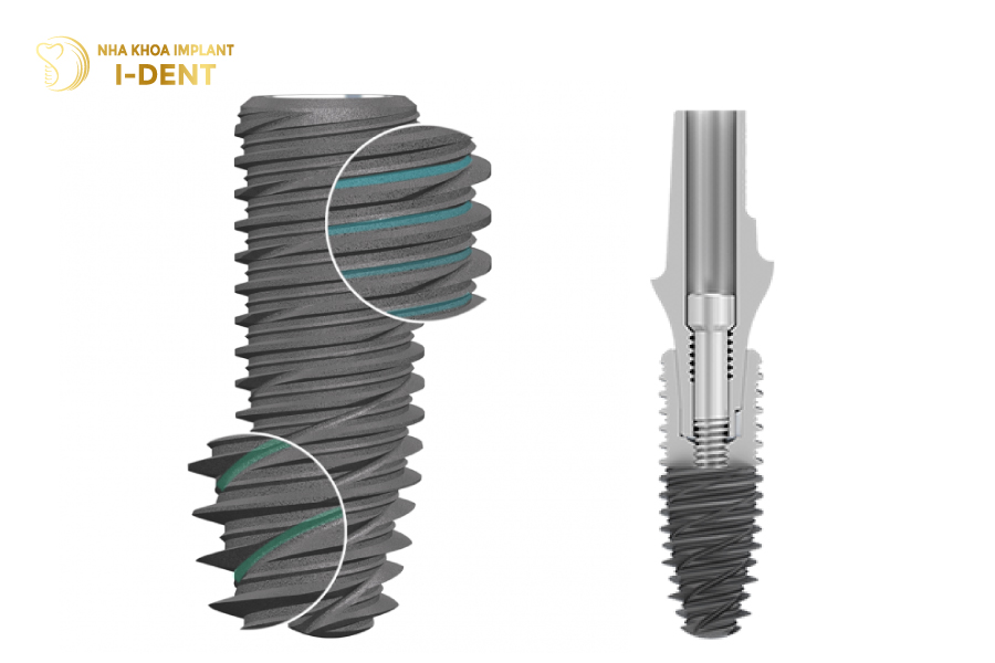Implant Kontact Implant Kontact