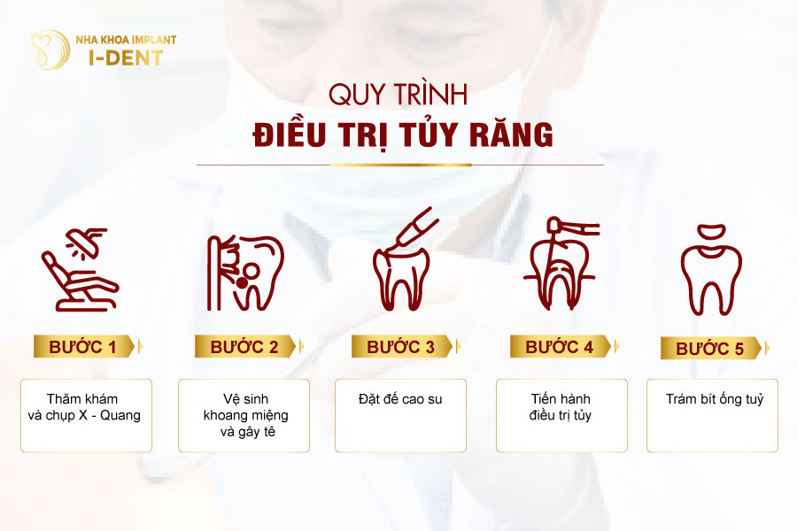 Quy trình lấy tủy tại Nha khoa I - DENT Quy trình lấy tủy tại Nha khoa I - DENT