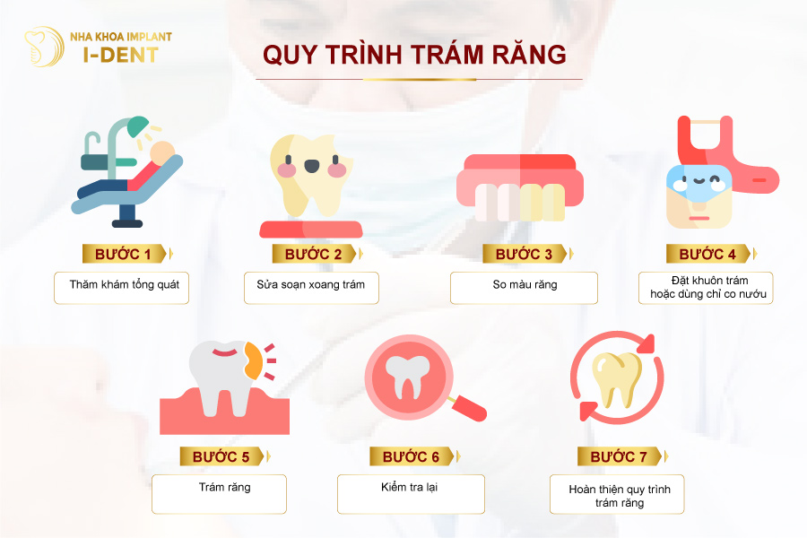 Quy trình trám răng thẩm mỹ Quy trình trám răng thẩm mỹ