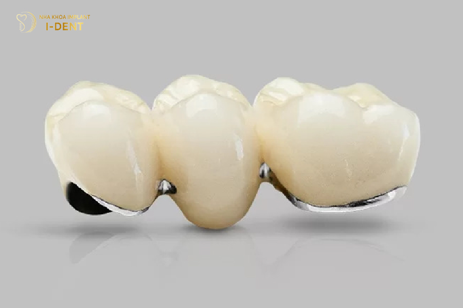 Răng sứ Ceramco Răng sứ Ceramco