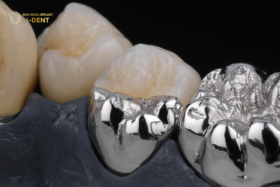 Hình ảnh răng sứ Chrome Cobalt Hình ảnh răng sứ Chrome Cobalt