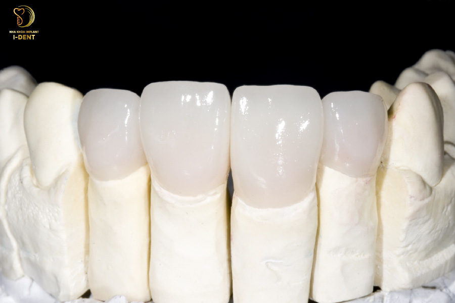 răng sứ zirconia giá rẻ - Răng sứ Zirconia răng sứ zirconia giá rẻ