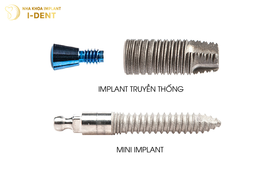 Kích thước của trụ mini Implant so với trụ thông thường Kích thước của trụ mini Implant so với trụ thông thường