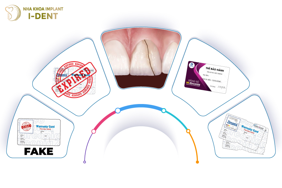 Những trường hợp thẻ bảo hành răng sứ không có hiệu lực Những trường hợp thẻ bảo hành răng sứ không có hiệu lực