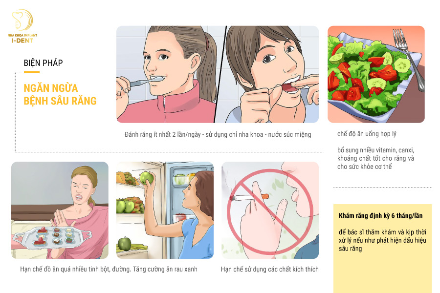 Biện pháp ngăn ngừa bệnh sâu răng Biện pháp ngăn ngừa bệnh sâu răng
