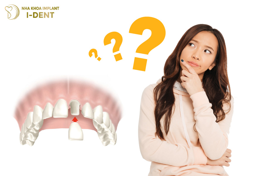 Bọc răng sứ có được vĩnh viễn không? Bọc răng sứ có được vĩnh viễn không?