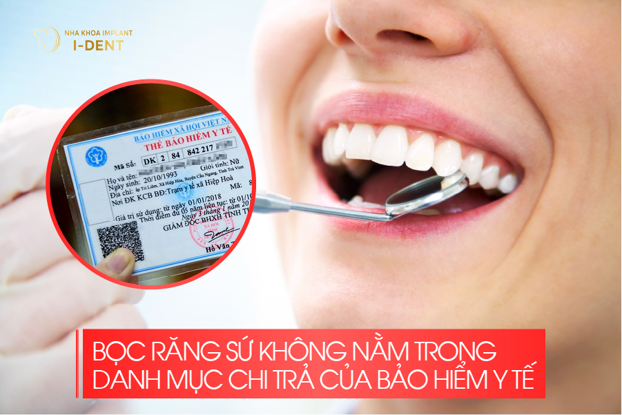 Bọc răng sứ không nằm trong danh mục chi trả của bảo hiểm y tế Bọc răng sứ không nằm trong danh mục chi trả của bảo hiểm y tế