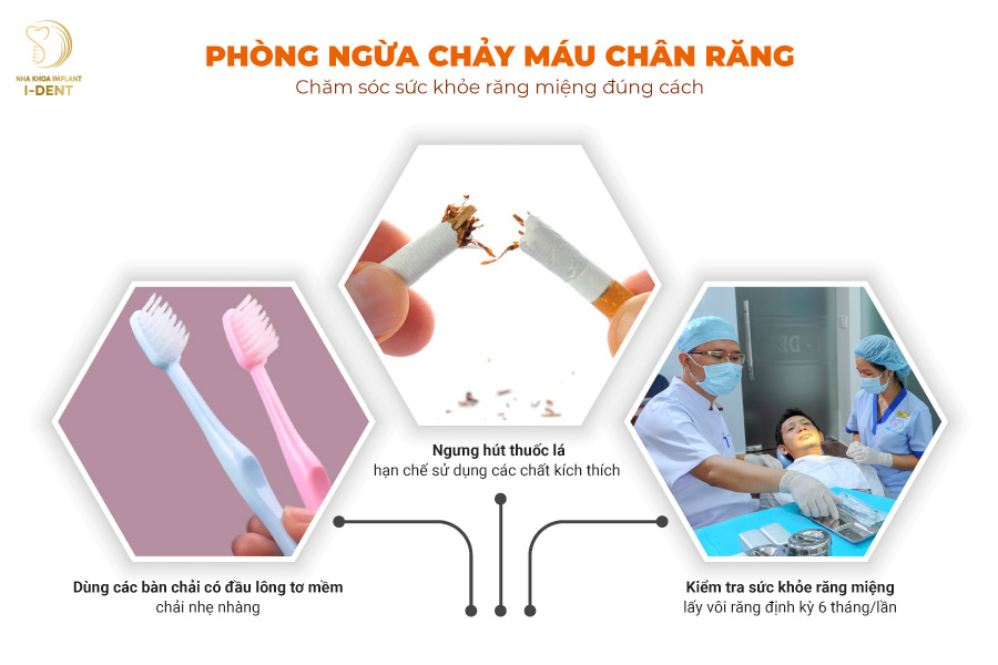 Cách phòng ngừa chảy máu chân răng Cách phòng ngừa chảy máu chân răng