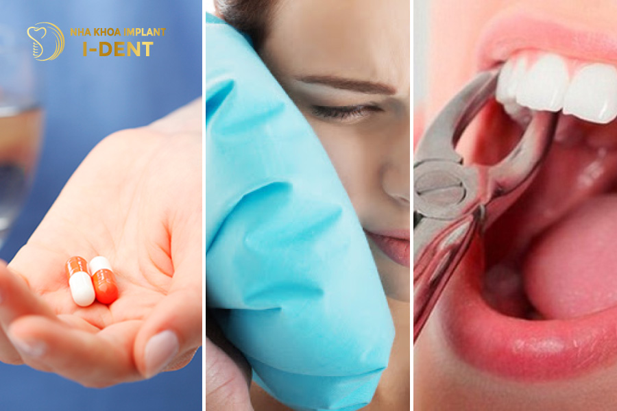Cần lưu ý những gì sau khi nhổ răng cửa Cần lưu ý những gì sau khi nhổ răng cửa