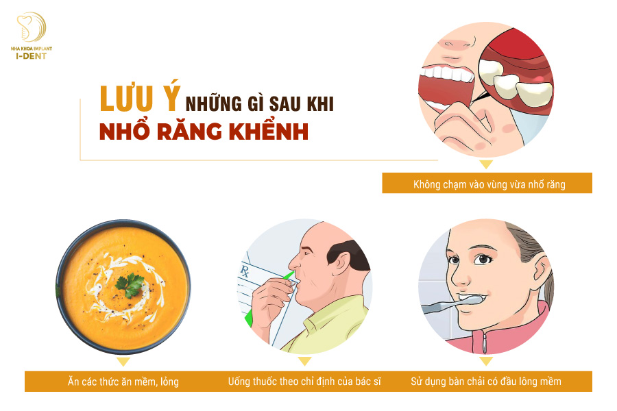 Cần lưu ý những gì sau khi nhổ răng khểnh Cần lưu ý những gì sau khi nhổ răng khểnh