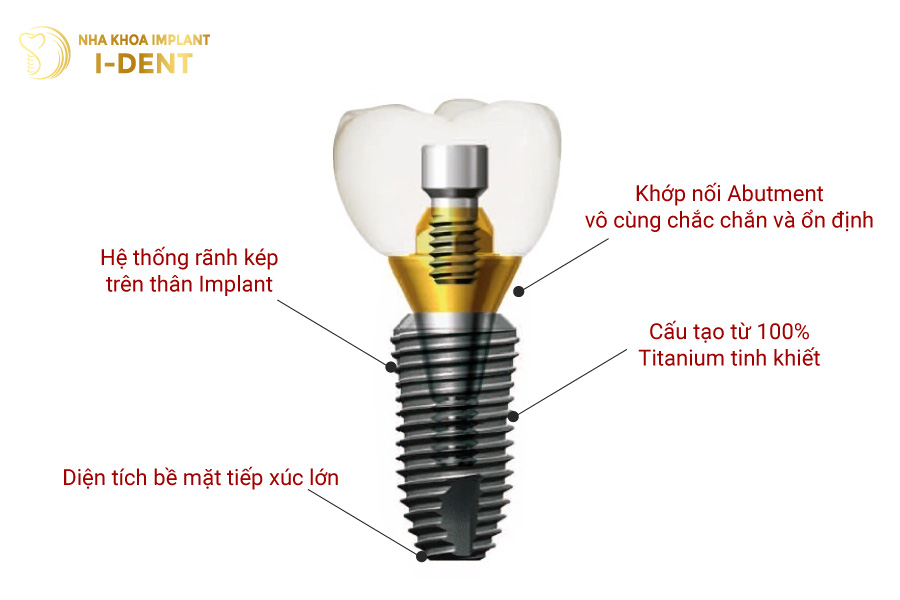Thân trụ Dentium Mỹ có các rãnh kép, giúp tích hợp xương nhanh chóng hơn Thân trụ Dentium Mỹ có các rãnh kép, giúp tích hợp xương nhanh chóng hơn