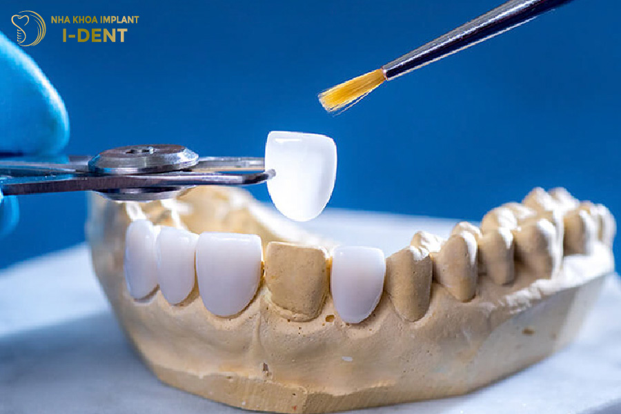 Chỉ nên sử dụng mặt sứ chính hãng để đảm bảo chất lượng Chỉ nên sử dụng mặt sứ chính hãng để đảm bảo chất lượng