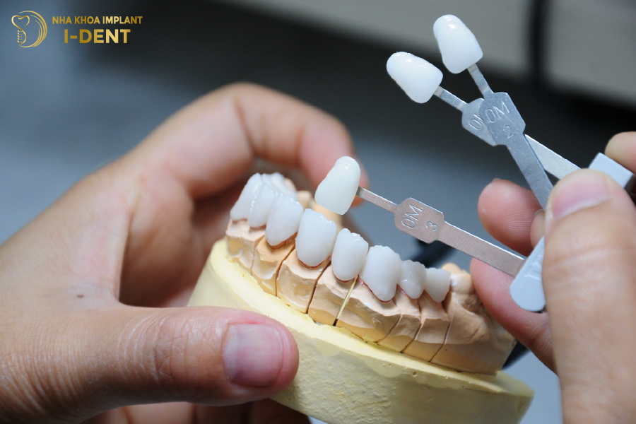 Chọn loại răng sứ nào để bọc cho bé? Chọn loại răng sứ nào để bọc cho bé?