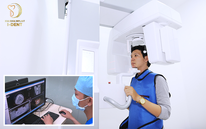 Chụp CT 3D nhằm xác định tình trạng răng Chụp CT 3D nhằm xác định tình trạng răng