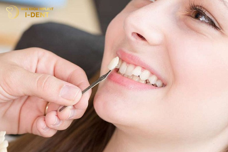 Bọc răng sứ cho răng khấp khểnh sẽ trắng sáng và đều màu hơn Bọc răng sứ cho răng khấp khểnh sẽ trắng sáng và đều màu hơn
