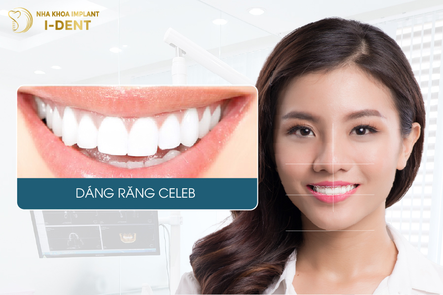 Dáng răng Celeb chuẩn sao Dáng răng sứ celeb