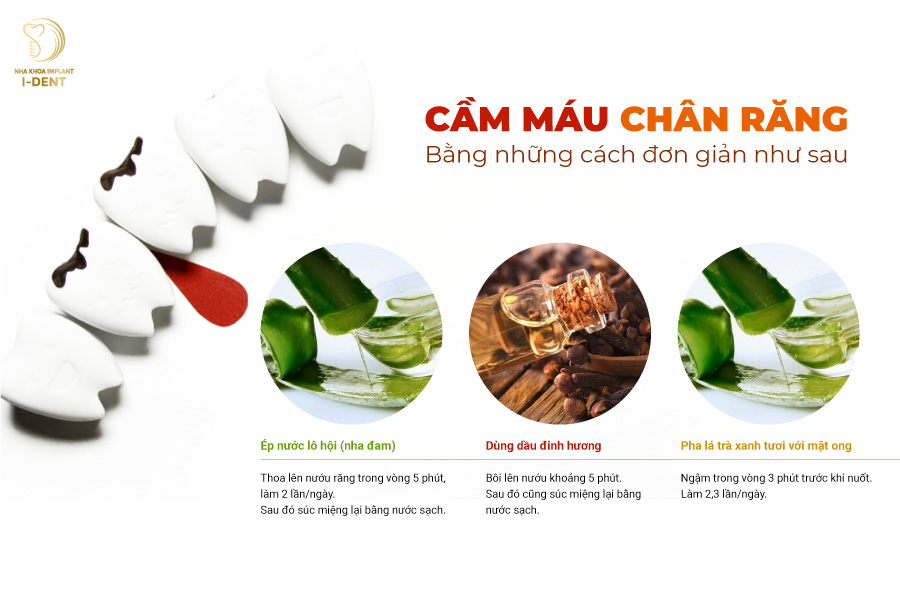 Những cách cầm máu chân răng đơn giản Những cách cầm máu chân răng đơn giản