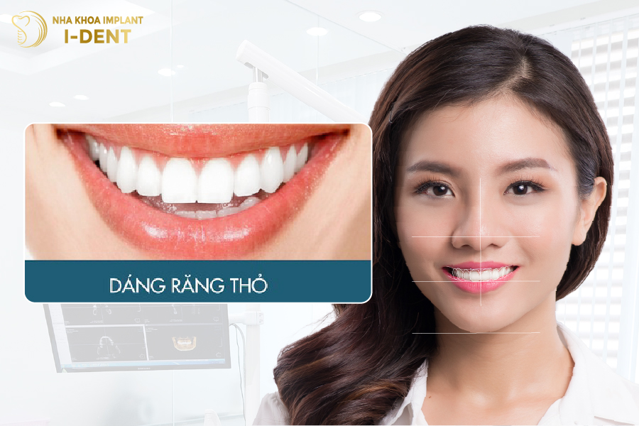 Form răng thỏ Form răng thỏ