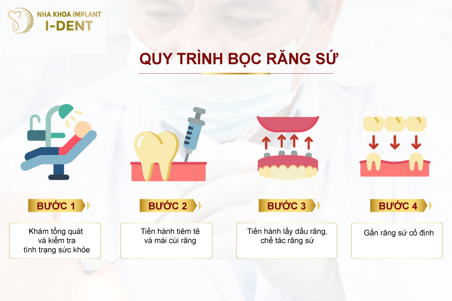 Quy trình dán răng sứ Veneer Quy trình dán răng sứ Veneer