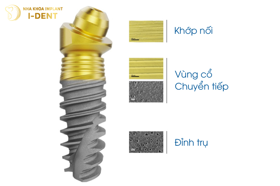 Implant Nobel Biocare Implant Nobel Biocare