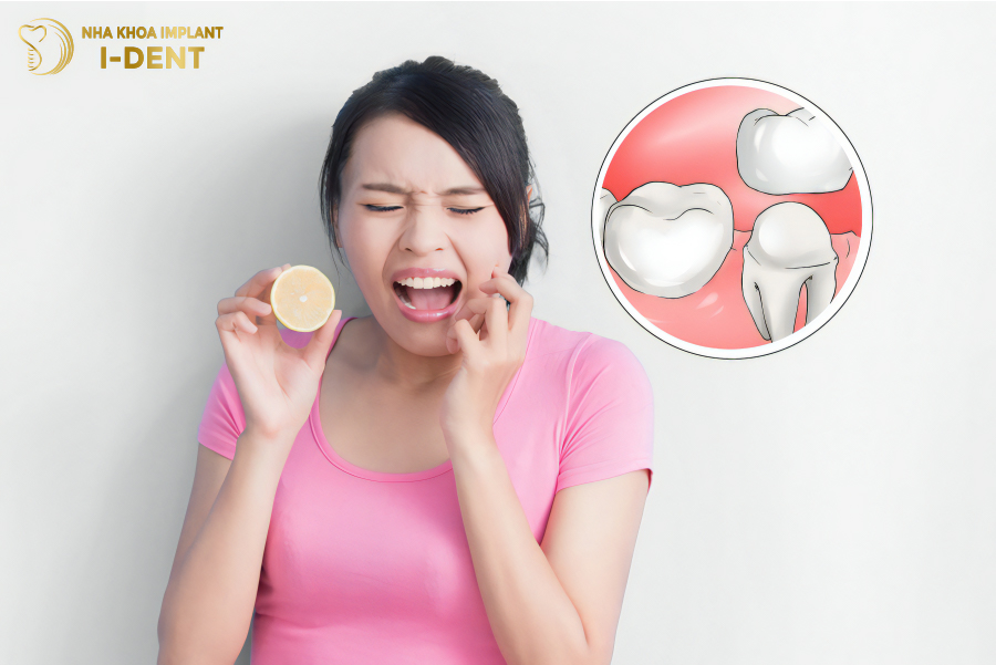 Làm răng sứ sau bao lâu thì hết ê buốt? Làm răng sứ sau bao lâu thì hết ê buốt?