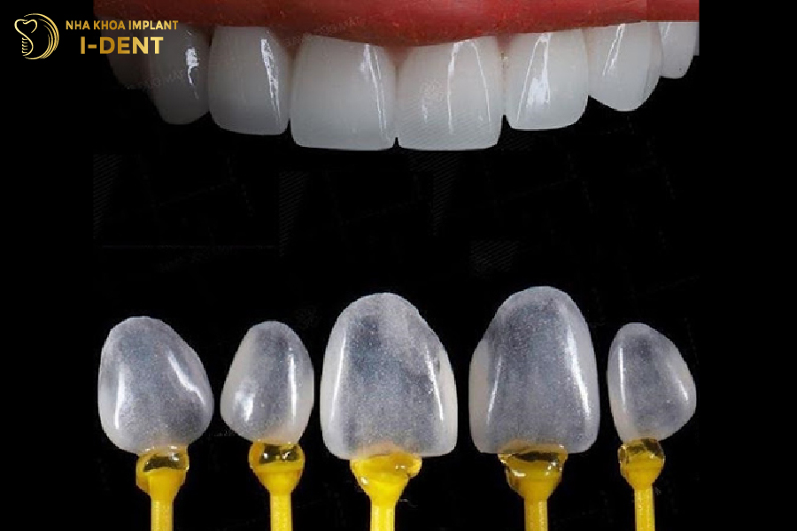 Mặt dán sứ Lisi Press Ultra Thin Mặt dán sứ Lisi Press Ultra Thin