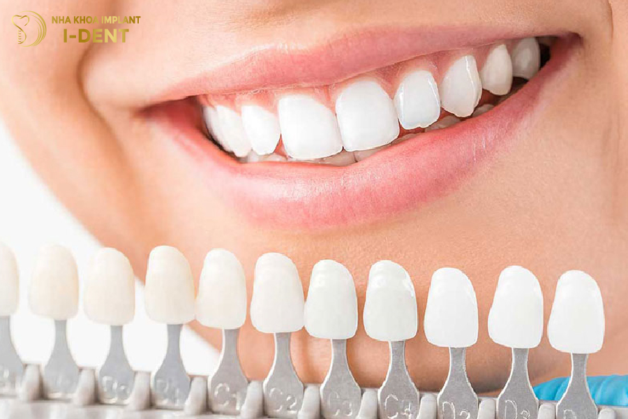 Răng sứ có dải màu đa dạng, phù hợp với nhiều tình trạng răng khác nhau Răng sứ có dải màu đa dạng, phù hợp với nhiều tình trạng răng khác nhau
