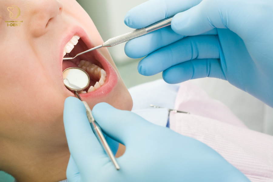 Nhổ răng cho trẻ để điều trị viêm tủy Nhổ răng cho trẻ để điều trị viêm tủy