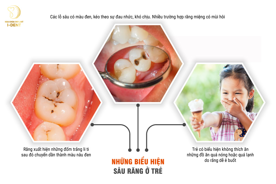 Những biểu hiện sâu răng ở trẻ nhỏ Những biểu hiện sâu răng ở trẻ nhỏ
