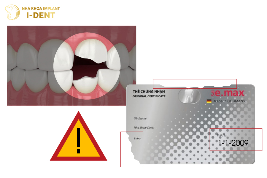 Những trường hợp thẻ bảo hành răng sứ emax không có hiệu lực Những trường hợp thẻ bảo hành răng sứ emax không có hiệu lực