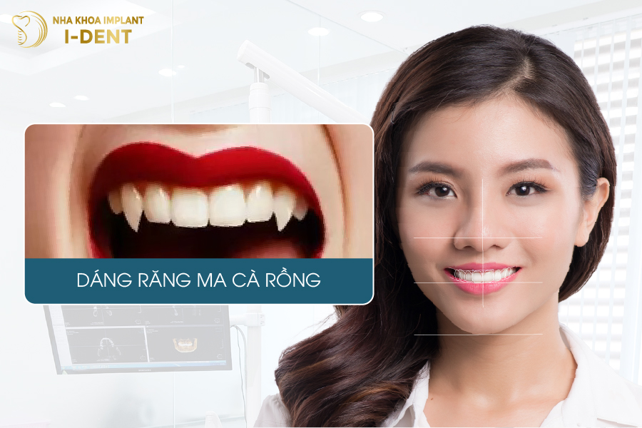 Phong cách dân chơi dáng răng ma cà rồng các dáng răng sứ