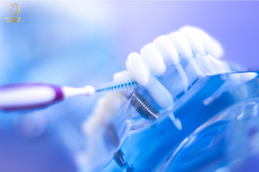 Thói quen chăm sóc răng miệng Thói quen chăm sóc răng miệng