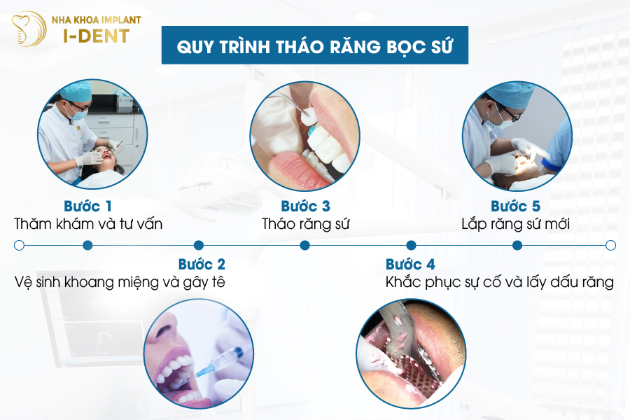 Cách tháo răng bọc sứ như thế nào? Cách tháo răng bọc sứ như thế nào?