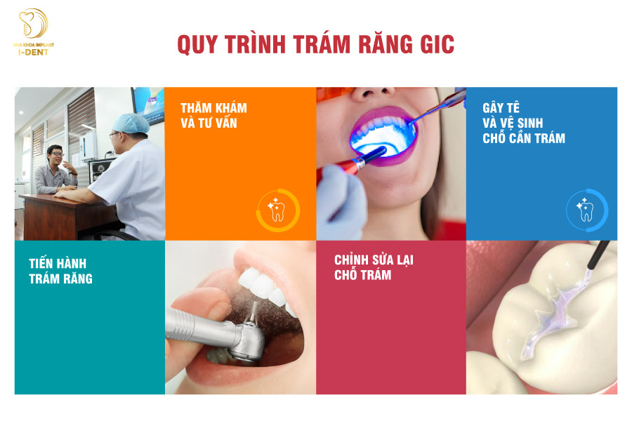 Quy trình trám răng GIC Quy trình trám răng GIC