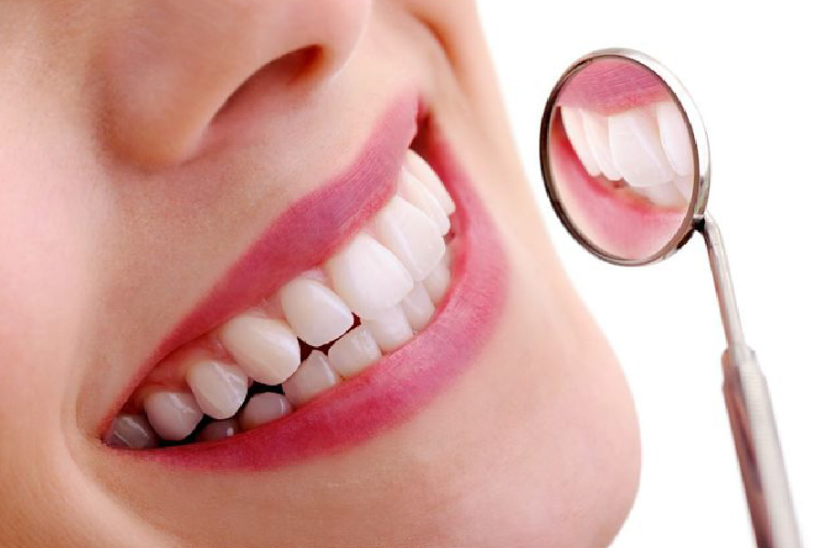 Răng cửa hô do răng mọc lệch thì có thể khắc phục bằng cách bọc sứ Răng cửa hô do răng mọc lệch thì có thể khắc phục bằng cách bọc sứ