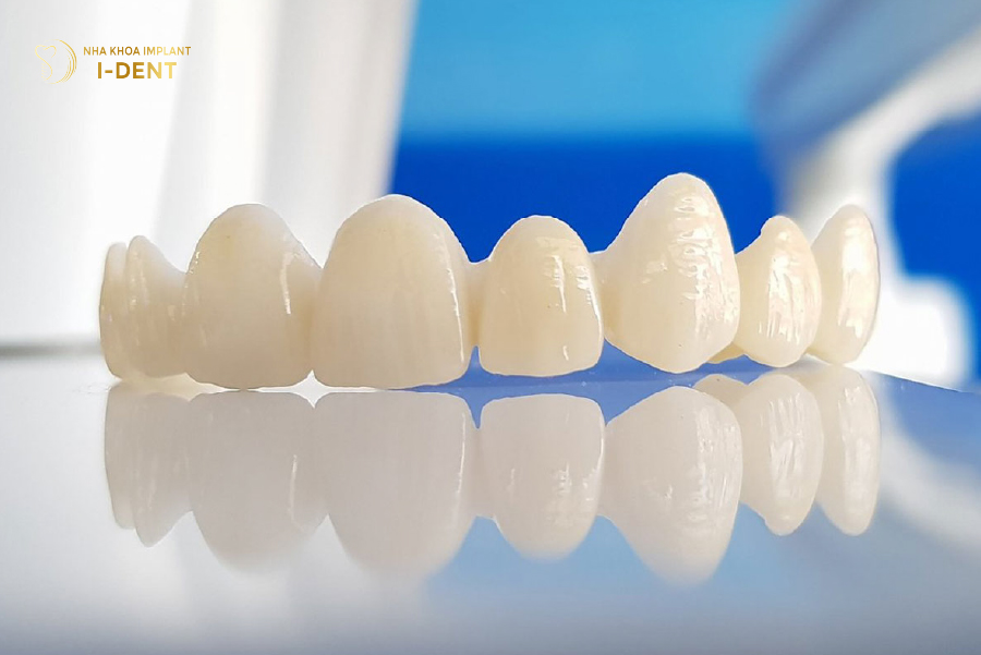 Răng sứ Centonia không gây đen viền nướu Răng sứ Centonia không gây đen viền nướu