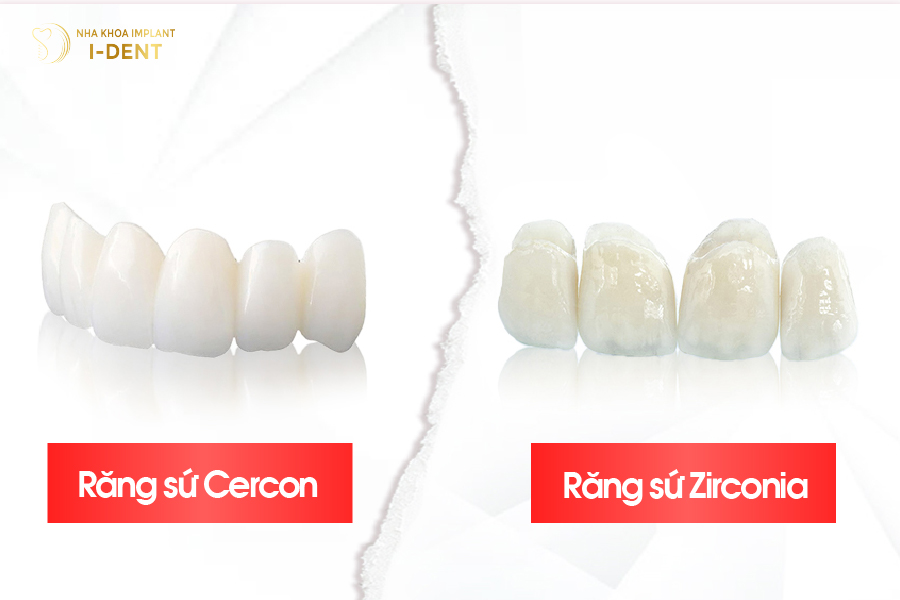 Răng sứ Cercon và răng sứ Zirconia Răng sứ Cercon và răng sứ Zirconia