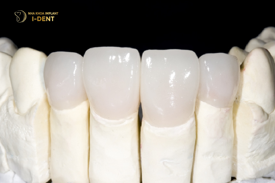 răng sứ DDBio HT răng sứ DDBio HT