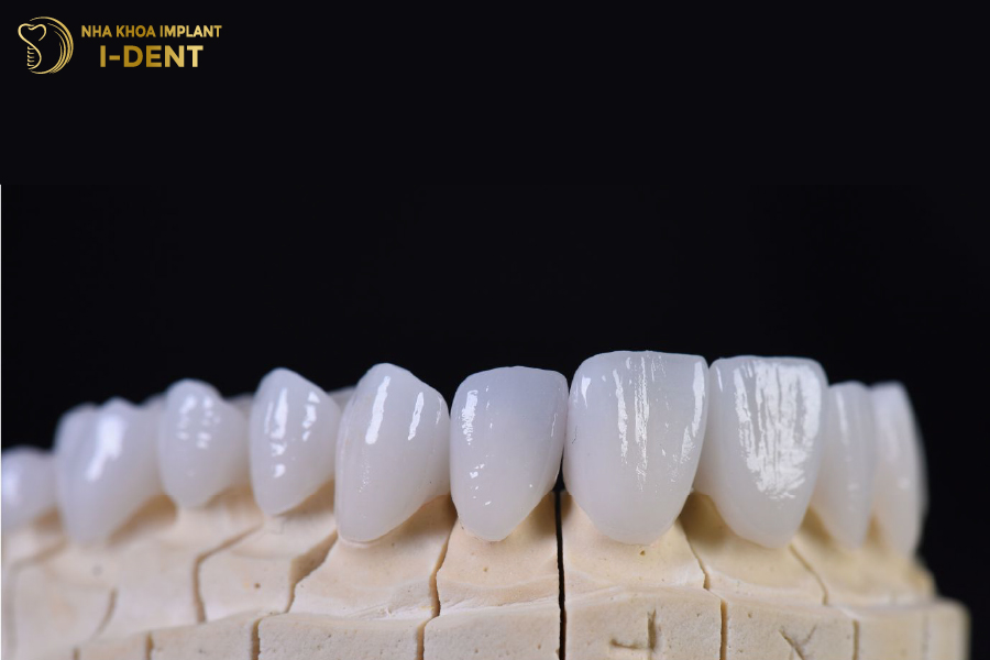 Răng sứ HT Smile đến từ Đức Răng sứ HT Smile đến từ Đức