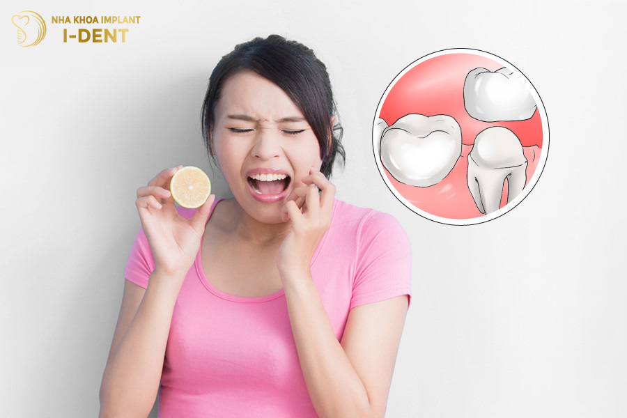 Răng sứ kém chất lượng gây cho răng bị ê buốt sau khi bọc Răng sứ kém chất lượng gây cho răng bị ê buốt sau khi bọc