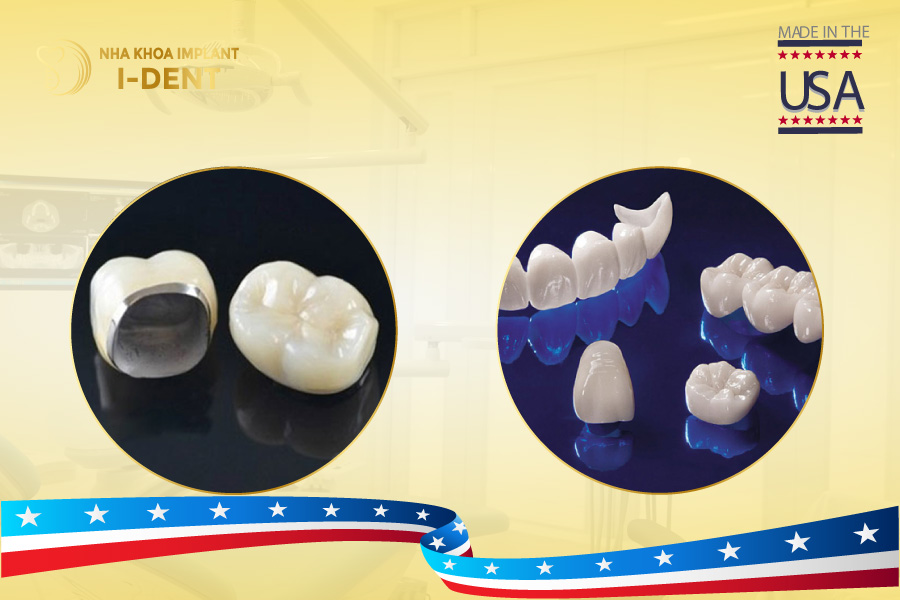 Răng sứ Mỹ Răng sứ Mỹ