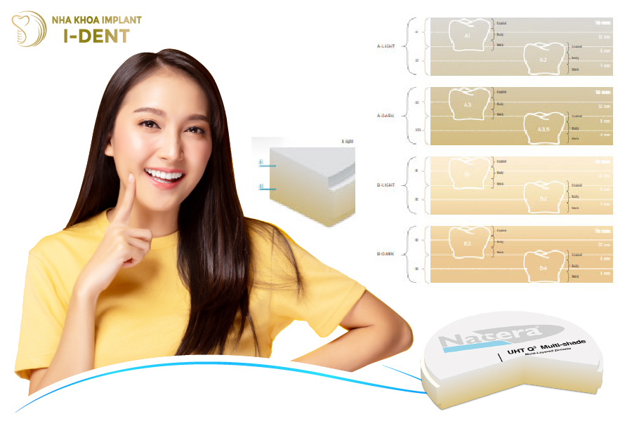 Răng sứ Nacera Q3 có tính thẩm mỹ cao Răng sứ Nacera Q3 có tính thẩm mỹ cao
