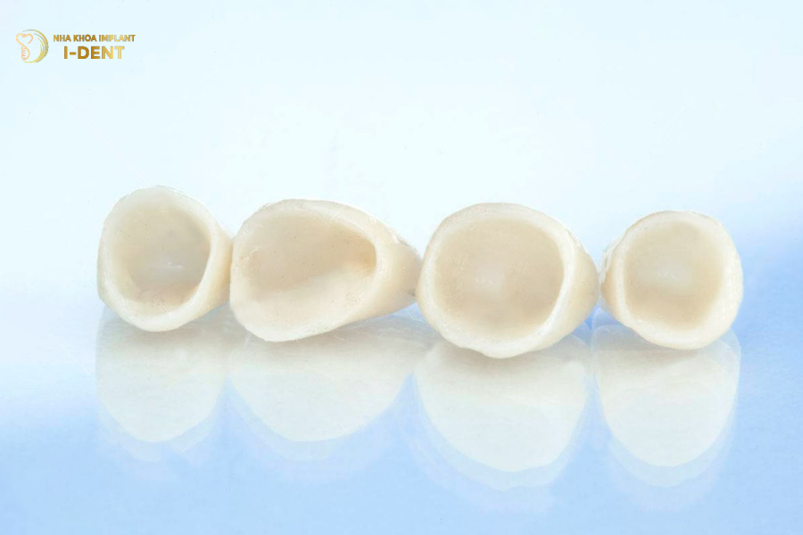 Răng sứ toàn sứ Răng sứ toàn sứ