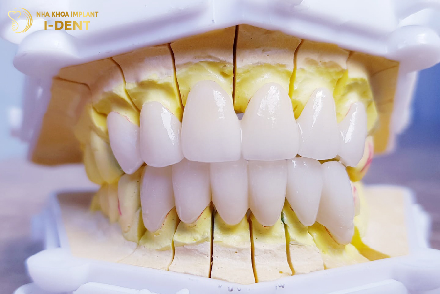 Răng sứ Zirconia Răng sứ Zirconia