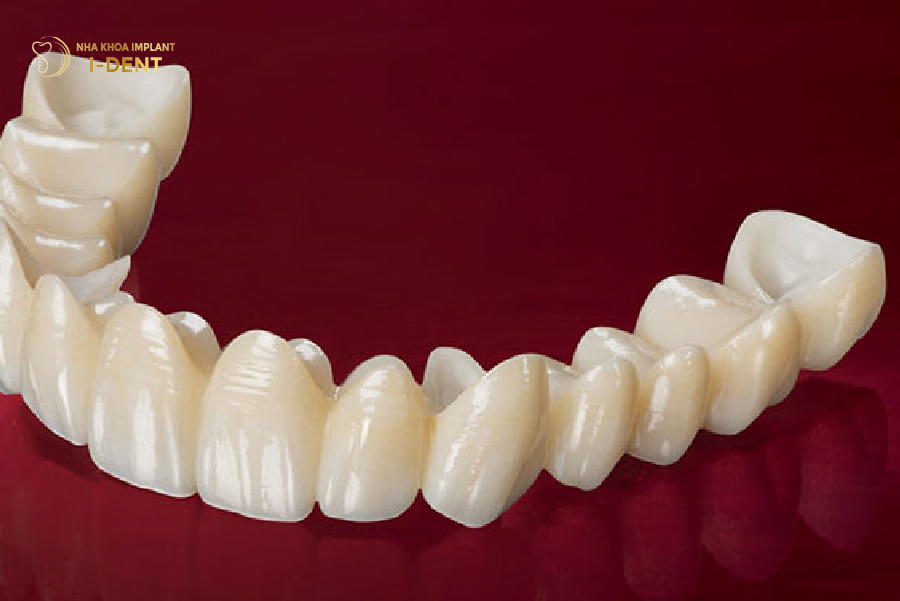 Răng sứ Zirconia cải thiện thẩm mỹ vùng răng nhai Răng sứ Zirconia cải thiện thẩm mỹ vùng răng nhai