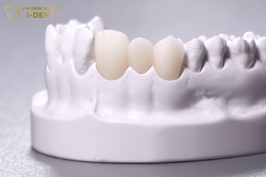 Răng sứ Zirconia rất phổ biến và được nhiều người ưa chuộng Răng sứ Zirconia rất phổ biến và được nhiều người ưa chuộng