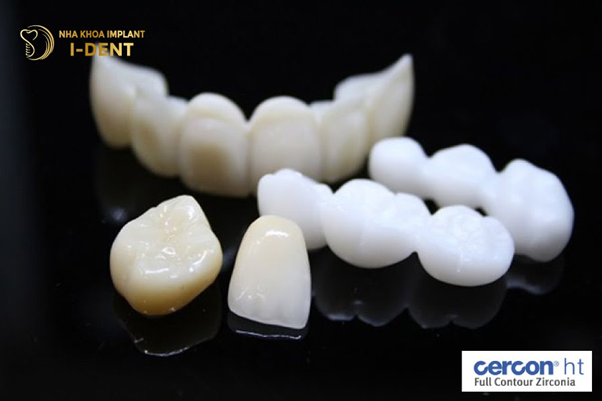 Răng sứ Cercon HT Răng sứ Cercon HT