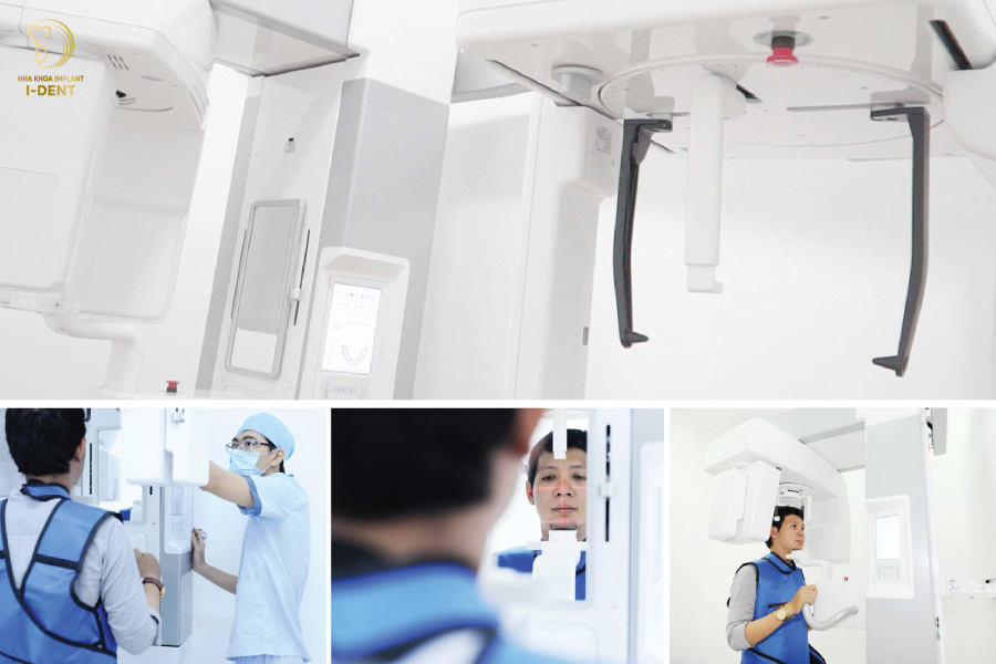 Thăm khám và chụp X-quang điều trị tủy răng Thăm khám và chụp X-quang điều trị tủy răng